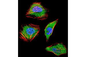 Fluorescent confocal image of Hela cell stained with SMAD4 Antibody . (SMAD4 抗体  (C-Term))