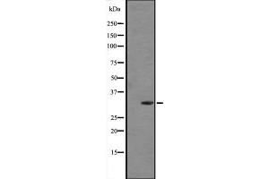 Western blot analysis of FGF5 expression in Human placenta tissue lysate (in RIPA buffer) ;,The lane on the left is treated with the antigen-specific peptide. (FGF5 抗体  (C-Term))