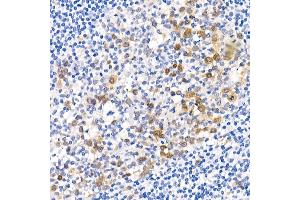 Immunohistochemistry of paraffin-embedded human placenta using Phospho--S473 Rabbit mAb (ABIN6135179, ABIN6135970, ABIN6135971 and ABIN7101880) at dilution of 1:100 (40x lens). (AKT1 抗体  (pSer473))