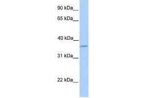 LAYN antibody used at 1 ug/ml to detect target protein. (Layilin 抗体  (N-Term))