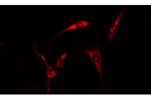 ABIN6274679 staining HT29 cells by IF/ICC. (CIDEB 抗体  (Internal Region))