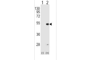 Western blot analysis of FDFT1 (arrow) using rabbit polyclonal FDFT1 Antibody (E11) (ABIN389051 and ABIN2839260). (FDFT1 抗体  (N-Term))