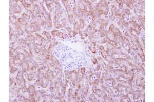 IHC-P Image ANKRD45 antibody detects ANKRD45 protein at cytosol on human normal liver by immunohistochemical analysis. (ANKRD45 抗体)