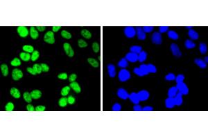 HeLa cells were fixed in paraformaldehyde, permeabilized with 0. (HDAC2 抗体)