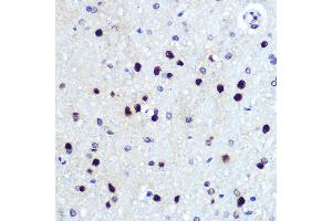 Immunohistochemistry of paraffin-embedded rat brain using HES1 Rabbit mAb (ABIN7267624) at dilution of 1:100 (40x lens). (HES1 抗体)