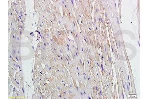 Formalin-fixed and paraffin embedded rat heart labeled with Anti Connexin-37/GJA4 Polyclonal Antibody, Unconjugated  at 1:200 followed by conjugation to the secondary antibody and DAB staining (GJA4 抗体  (AA 151-250))