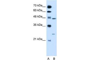 WB Suggested Anti-RXRG Antibody Titration:  0. (Retinoid X Receptor gamma 抗体  (N-Term))