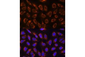 Immunofluorescence analysis of U-2 OS cells using GANAB antibody  at dilution of 1:100. (GANAB 抗体  (AA 1-260))