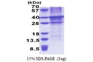 SDS-PAGE (SDS) image for Tissue Factor Pathway Inhibitor (Lipoprotein-Associated Coagulation Inhibitor) (TFPI) (AA 29-304) protein (His tag) (ABIN5853247) (TFPI Protein (AA 29-304) (His tag))