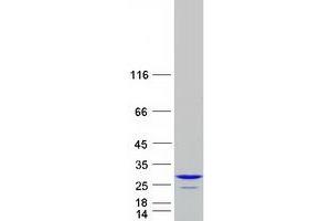 Western Blotting (WB) image for ADP-Ribosylation Factor-Like 3 (ARL3) protein (Myc-DYKDDDDK Tag) (ABIN2714909)