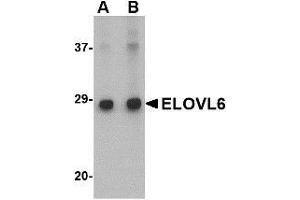 Western blot analysis of ELOVL6 in Human brain tissue lysate with ELOVL6 antibody at (A) 1 and (B) 2 μg/ml. (ELOVL6 抗体  (N-Term))