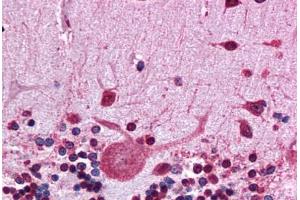 Immunohistochemistry (Formalin-fixed Paraffin-embedded Sections) (IHC (fp)) image for anti-Heat Shock Protein 90kDa alpha (Cytosolic), Class B Member 1 (HSP90AB1) (N-Term) antibody (ABIN574430)