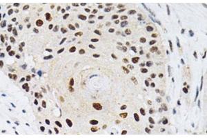 Immunohistochemistry (Paraffin-embedded Sections) (IHC (p)) image for anti-Karyopherin (Importin) alpha 4 (KPNA4) antibody (ABIN7260071)