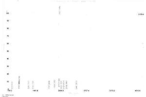 Image no. 1 for Prolactin (PRL) peptide (Ovalbumin) (ABIN5666359) (Prolactin (PRL) peptide (Ovalbumin))