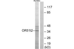 Western blot analysis of extracts from HUVEC cells, using OR51I2 antibody. (OR51I2 抗体  (Internal Region))