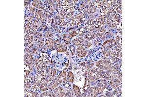 IHC analysis of SUCLG2 using anti-SUCLG2 antibody (ABIN7601694).