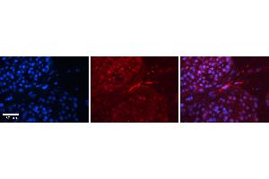 Rabbit Anti-EWSR1 Antibody   Formalin Fixed Paraffin Embedded Tissue: Human Testis Tissue Observed Staining: Cytoplasm, nucleus and plasma membrane in spermatogonia, spermatocytes and smooth muscle cells Primary Antibody Concentration: 1:100 Other Working Concentrations: 1:600 Secondary Antibody: Donkey anti-Rabbit-Cy3 Secondary Antibody Concentration: 1:200 Magnification: 20X Exposure Time: 0. (EWSR1 抗体  (N-Term))