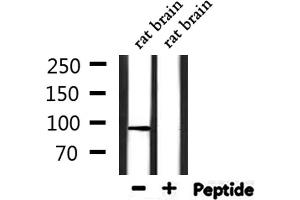 Western blot analysis of extracts from rat brain, using TRPV4 Antibody.