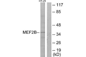 Western blot analysis of extracts from HT-29 cells, using MEF2B antibody. (MEF2B 抗体  (Internal Region))