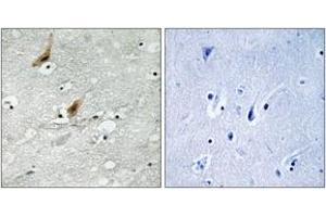 Immunohistochemistry analysis of paraffin-embedded human brain, using MSK2 (Phospho-Thr568) Antibody. (MSK2 抗体  (pThr568))