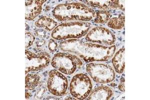 Immunohistochemical staining of human kidney with KIF5A polyclonal antibody  shows strong cytoplasmic positivity in tubular cells.
