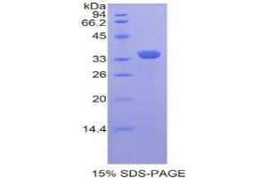SDS-PAGE analysis of Rat PRDM1 Protein. (PRDM1 蛋白)