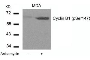 Western blot analysis of extracts from MDA cells untreated or treated with Anisomycin using Cyclin B1(phospho-Ser147) Antibody. (Cyclin B1 抗体  (pSer147))