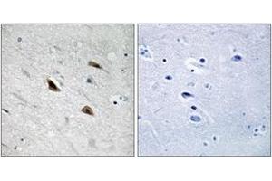 Immunohistochemistry (IHC) image for anti-Catenin, beta (CATNB) (AA 455-504), (pTyr489) antibody (ABIN1532004)