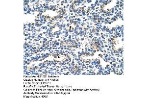 Rabbit Anti-EIF2S1 Antibody  Paraffin Embedded Tissue: Human Lung Cellular Data: Alveolar cells Antibody Concentration: 4. (EIF2S1 抗体  (C-Term))