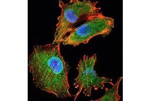 Immunofluorescence analysis of U251 cells using IL34 mouse mAb (green). (IL-34 抗体)