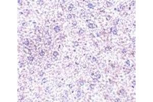 Immunohistochemistry (IHC) image for anti-Plexin Domain Containing 1 (PLXDC1) (C-Term) antibody (ABIN1030730) (PLXDC1 抗体  (C-Term))