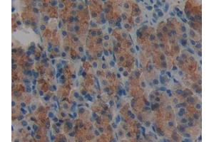 IHC-P analysis of Rat Stomach Tissue, with DAB staining. (AGRN 抗体  (AA 1206-1475))