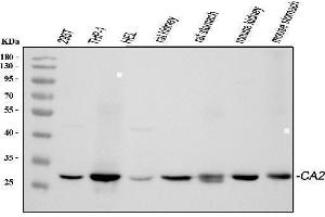Western blot analysis of CA2 using anti-CA2 antibody (ABIN4886493).