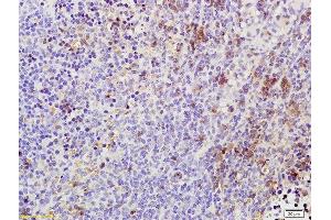 Formalin-fixed and paraffin embedded rat spleen labeled with Rabbit Anti Phospho-TAK1(Thr184/187) Polyclonal Antibody, Unconjugated (ABIN746348) at 1:200 followed by conjugation to the secondary antibody and DAB staining (TR4 抗体  (pThr184, pThr187))