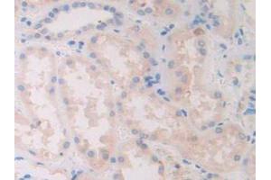 IHC-P analysis of Human Kidney Tissue, with DAB staining. (SLIT1 抗体  (AA 647-835))