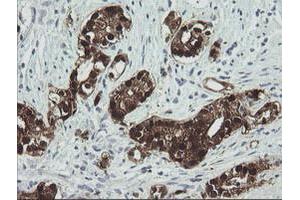 Image no. 4 for anti-Cytidine Monophosphate (UMP-CMP) Kinase 1, Cytosolic (CMPK1) antibody (ABIN1497544) (Cytidine Monophosphate (UMP-CMP) Kinase 1, Cytosolic (CMPK1) 抗体)