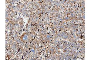 IHC analysis of MRC1 using anti-MRC1 antibody (ABIN7600593).