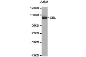 Western Blotting (WB) image for anti-Cas-Br-M (Murine) Ecotropic Retroviral Transforming Sequence (CBL) antibody (ABIN1871485) (CBL 抗体)