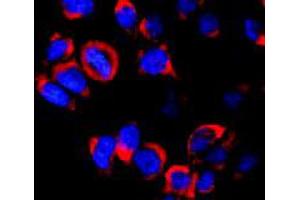 Immunofluorescence staining of vesicles (red) in RBL-2H3 (rat basophilic leukemia cell line) using Kinesin (heavy chain) monoclonal antibody, clone KN-02 . (Kinesin (heavy chain) 抗体)