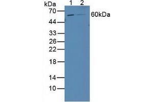 Western blot analysis of (1) Human 293T Cells and (2) Human HepG2 Cells. (Retinoic Acid Receptor beta 抗体  (AA 205-451))