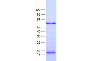 Western Blotting (WB) image for Zinc Finger Protein 280A (ZNF280A) protein (His tag) (ABIN2732928)