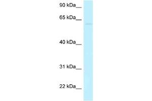 WB Suggested Anti-CCDC105 Antibody Titration: 1. (CCDC105 抗体  (C-Term))