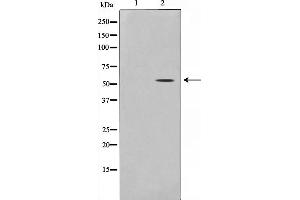 Western blot analysis on 293 cell lysate using THR1 Antibody (THRB 抗体  (Internal Region))
