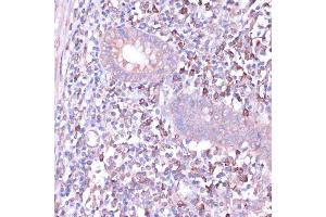 Immunohistochemistry (IHC) image for anti-Protein Kinase, CAMP Dependent, Catalytic, beta (PRKACB) (AA 1-351) antibody (ABIN6146183)