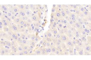 Detection of ABCC6 in Mouse Liver Tissue using Polyclonal Antibody to ATP Binding Cassette Transporter C6 (ABCC6) (ABCC6 抗体  (AA 1260-1498))