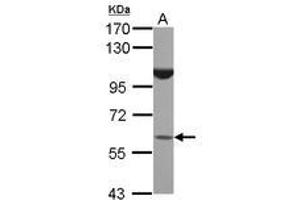 Image no. 1 for anti-BTB (POZ) Domain Containing 16 (BTBD16) (AA 1-255) antibody (ABIN1496968) (BTBD16 抗体  (AA 1-255))