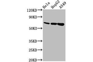 Western Blot Positive WB detected in: Hela whole cell lysate, HepG2 whole cell lysate, A549 whole cell lysate All lanes: MUC20 antibody at 5. (MUC2 抗体  (AA 569-657))