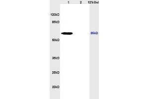 SDS-PAGE (SDS) image for anti-Solute Carrier Family 5 (Sodium/iodide Cotransporter), Member 5 (SLC5A5) (AA 525-618) antibody (ABIN668751)