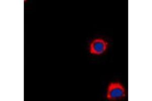 Immunofluorescent analysis of CD40 staining in A431 cells. (CD40 抗体  (C-Term))