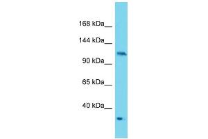Western Blotting (WB) image for anti-Protein Kinase N2 (PKN2) (C-Term) antibody (ABIN2788942) (PKN2 抗体  (C-Term))